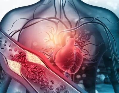 Soyez alerte à la mort cardiaque soudaine: dévoiler le tueur vasculaire silencieux négligé et comment la vitamine K2 protège le cœur